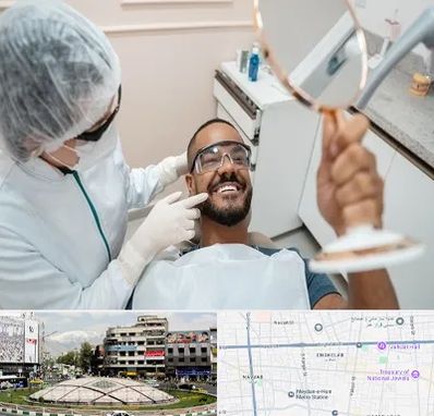 ایمپلنت فوری در مرکز تهران