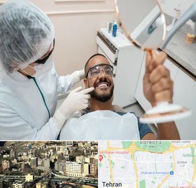 ایمپلنت فوری در مرزداران 