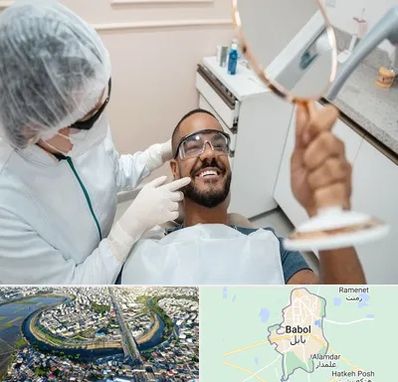 ایمپلنت فوری در بابل