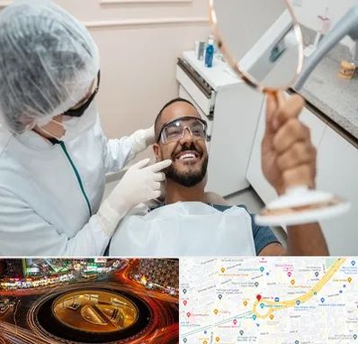 ایمپلنت فوری در میدان ولیعصر