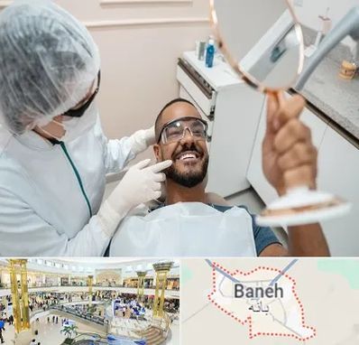 ایمپلنت فوری در بانه