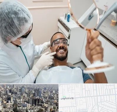 ایمپلنت فوری در جیحون