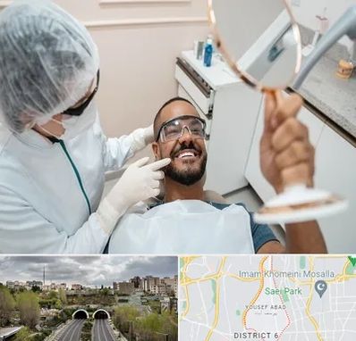 ایمپلنت فوری در یوسف آباد 