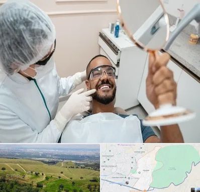 ایمپلنت فوری در سوهانک