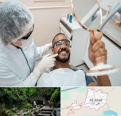 ایمپلنت فوری در علی آباد کتول