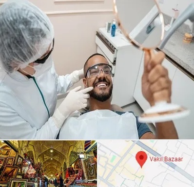 ایمپلنت فوری در بازار وکیل شیراز