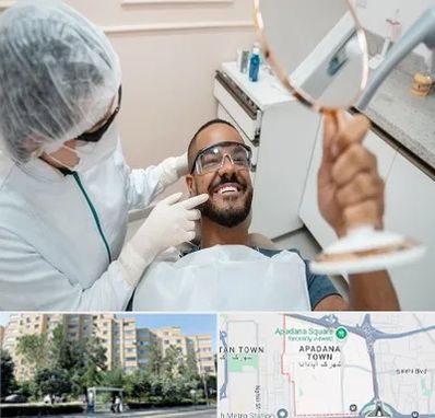 ایمپلنت فوری در آپادانا