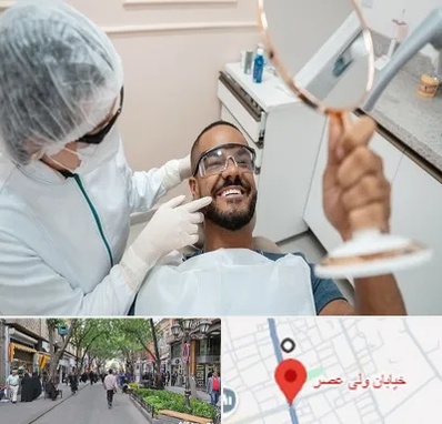 ایمپلنت فوری در ولیعصر شهریار