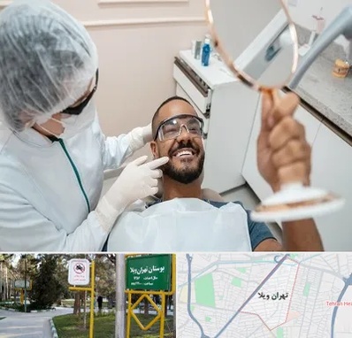 ایمپلنت فوری در تهران ویلا