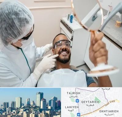 ایمپلنت فوری در قیطریه 