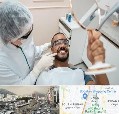 ایمپلنت فوری در پونک 