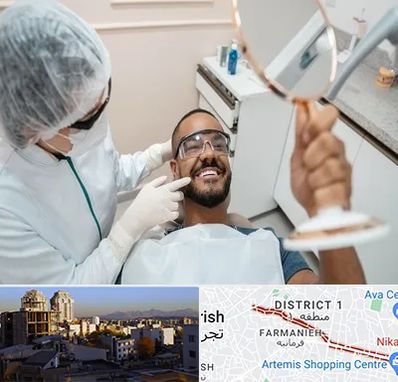 ایمپلنت فوری در فرمانیه 