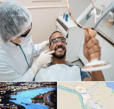 ایمپلنت فوری در خرمشهر