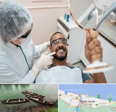 ایمپلنت فوری در بندر انزلی