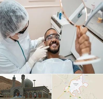 ایمپلنت فوری در شهرضا