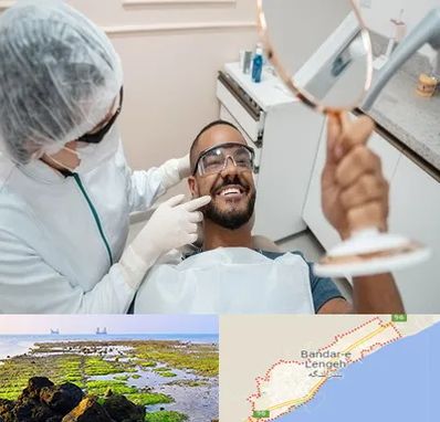 ایمپلنت فوری در بندرلنگه