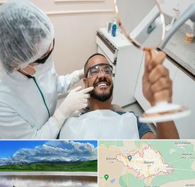 ایمپلنت فوری در مرند