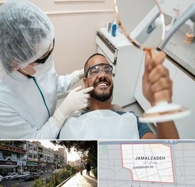 ایمپلنت فوری در خیابان جمالزاده