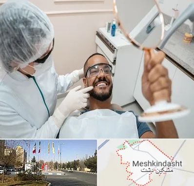 ایمپلنت فوری در مشکین دشت