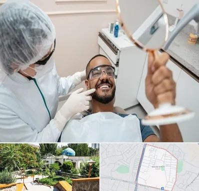 ایمپلنت فوری در باغمیشه تبریز