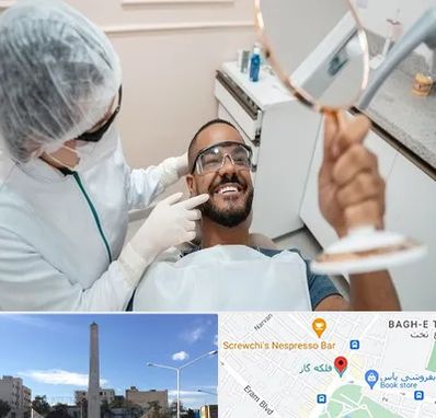 ایمپلنت فوری در فلکه گاز شیراز