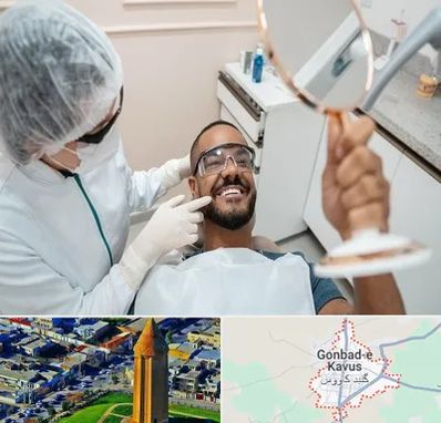 ایمپلنت فوری در گنبد کاووس