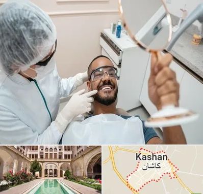 ایمپلنت فوری در کاشان