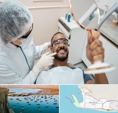 ایمپلنت فوری در چابهار