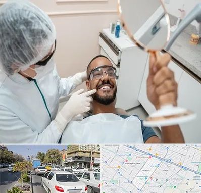 ایمپلنت فوری در مفتح مشهد