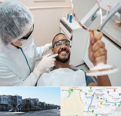 ایمپلنت فوری در شریعتی مشهد