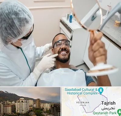 ایمپلنت فوری در زعفرانیه 