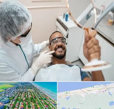 ایمپلنت فوری در فریدونکنار