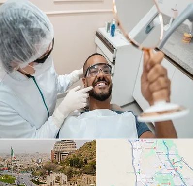 ایمپلنت فوری در فرهنگ شهر شیراز