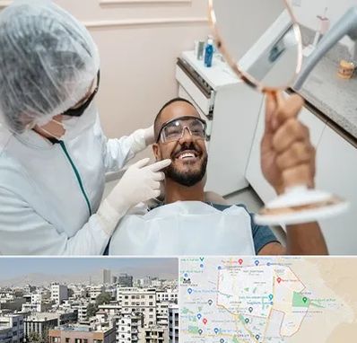 ایمپلنت فوری در منطقه 14 تهران