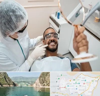 ایمپلنت فوری در ایلام