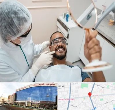 ایمپلنت فوری در نصف راه تبریز