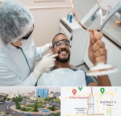 ایمپلنت فوری در ونک 