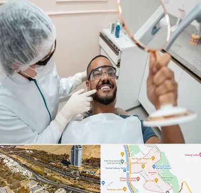 ایمپلنت فوری در خیابان نیایش شیراز