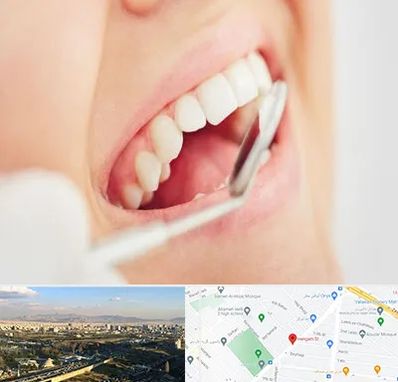 اصلاح طرح لبخند در هنگام