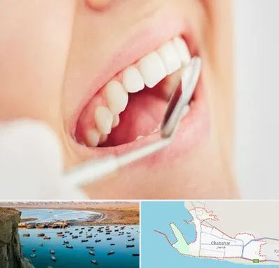 اصلاح طرح لبخند در چابهار