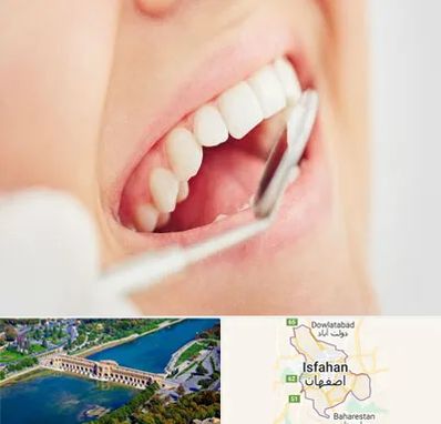 اصلاح طرح لبخند در اصفهان