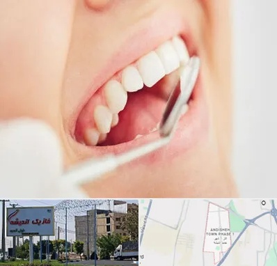 اصلاح طرح لبخند در فاز یک اندیشه