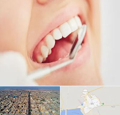 اصلاح طرح لبخند در بندر ماهشهر