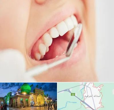 اصلاح طرح لبخند در آستانه اشرفیه