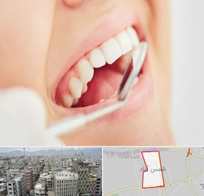 اصلاح طرح لبخند در شمس آباد تهران