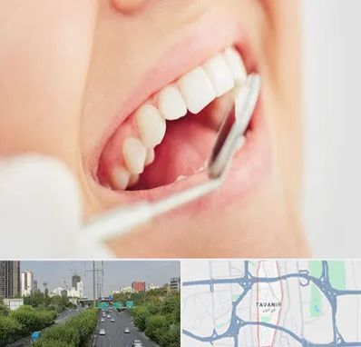 اصلاح طرح لبخند در توانیر