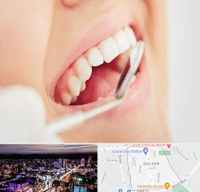 اصلاح طرح لبخند در گلسار رشت 