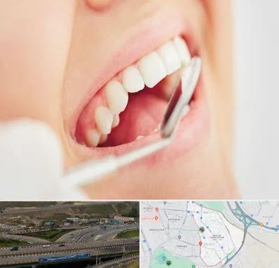 اصلاح طرح لبخند در یاغچیان تبریز