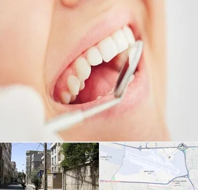 اصلاح طرح لبخند در مهرآباد