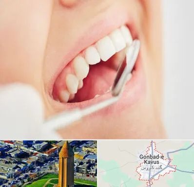 اصلاح طرح لبخند در گنبد کاووس